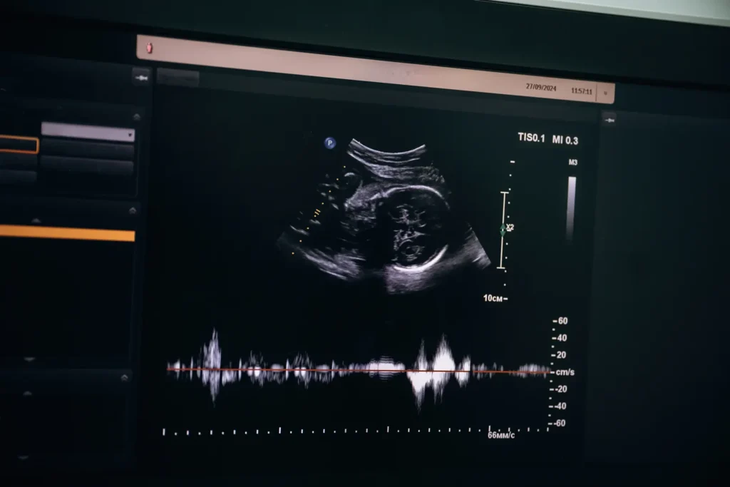 ultrasonic-machine-close-up-view-in-the-hospital